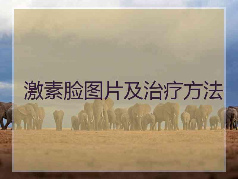 激素脸图片及治疗方法